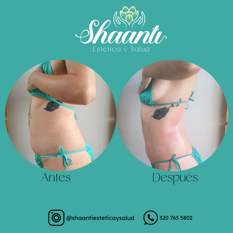 Tu mejor versión esta a un masaje de distancia_20250112_124713_0000