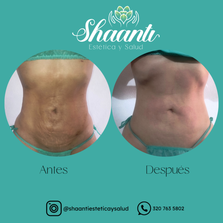 Tu mejor versión esta a un masaje de distancia_20250916_231447_0000