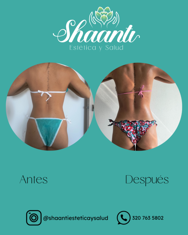 Tu mejor versión esta a un masaje de distancia_20260109_101258_0000