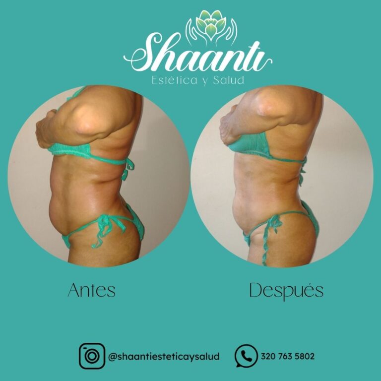 Tu mejor versión esta a un masaje de distancia_20260316_160216_0000