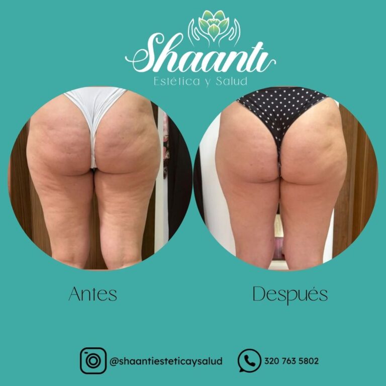 Tu mejor versión esta a un masaje de distancia_20260318_142248_0000